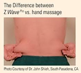 The difference between Z Wave and Hand Massage. Photo of back with side fat being pinched.