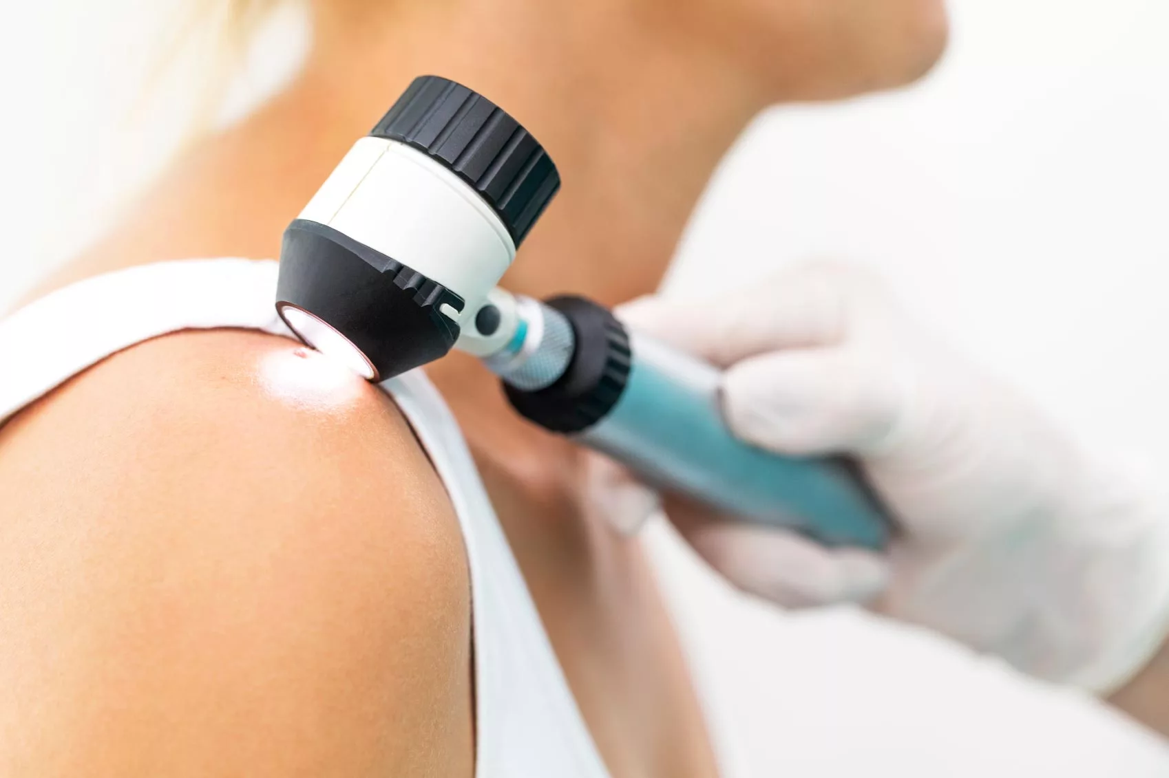 Skin Cancer Screening